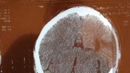 На снимке головного мозга женщины обнаружили лик Иисуса Христа