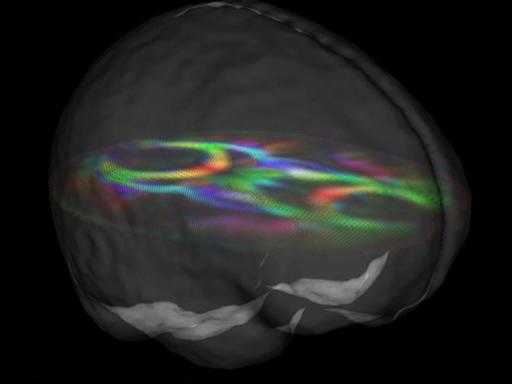 Исследования показали: мозг у людей с более высоким интеллектом имеет другие виды связей