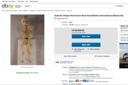Расследование газеты Mirror: Человеческие черепа и скелеты активно продаются на аукционах eBay