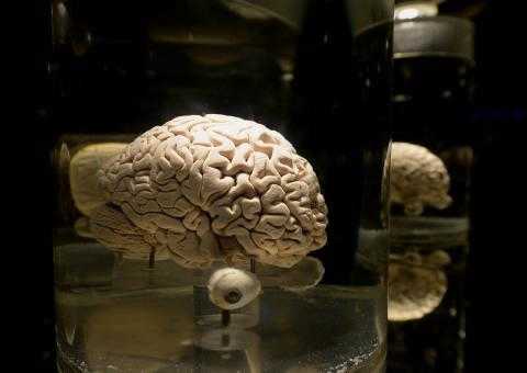 Ученые: не существует мужского или женского мозга