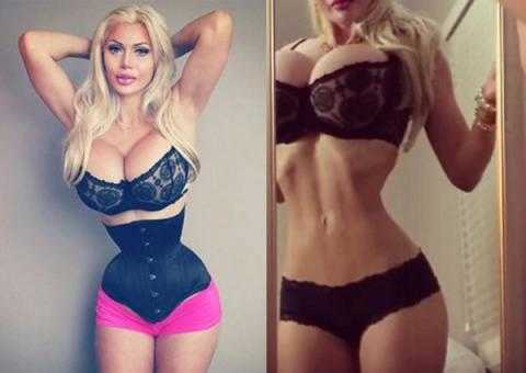 Woman with 16-inch waist may have to wear corset to stay alive