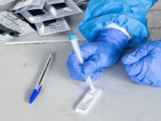 Јединице за брзо тестирање на антиген – 5. јануар 2022