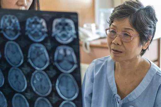 Oczekuje się, że do 2050 r. liczba przypadków demencji prawie się potroi, wynika z badań