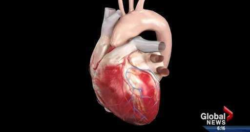 Канада - С нарастването на сърдечните усложнения канадските болници може да се изкривят, казват експерти