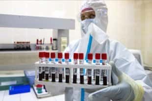 Росія - У лабораторії пояснили, як проходитиме оформлення QR-кодів за наявності антитіл