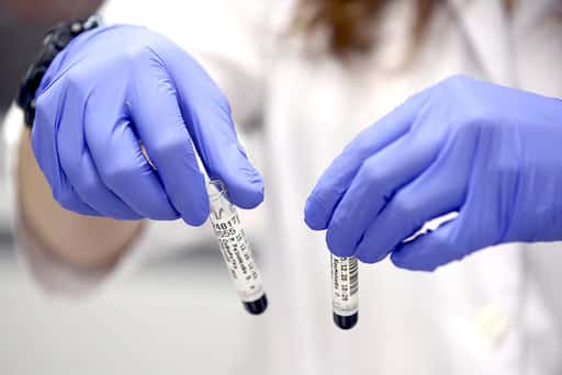 Russia - The Ministry of Health told which companies often inflate prices for PCR tests
