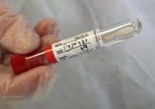 Na Hrvaškem je 6341 na novo okuženih s koronavirusom