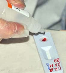 Ponad 900 mieszkańców dzielnicy Targowiszte zostało przebadanych w zeszłym roku na wirusowe zapalenie wątroby typu C, HIV i kiłę