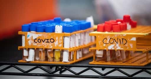 Canadá - COVID-19: MLHU informa 3 muertes, LHSC tiene 87 pacientes hospitalizados por COVID
