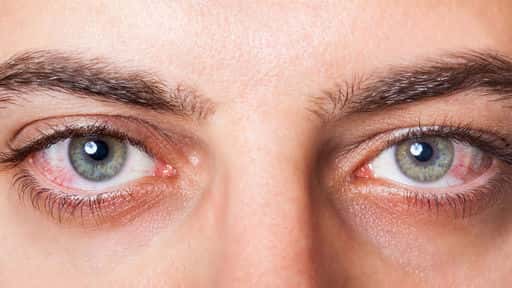 Doctorul Dementiev a spus cum bolile pot fi identificate de ochi