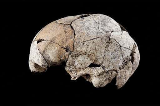 Lebka so stopami starovekej operácie uší nájdená v Španielsku