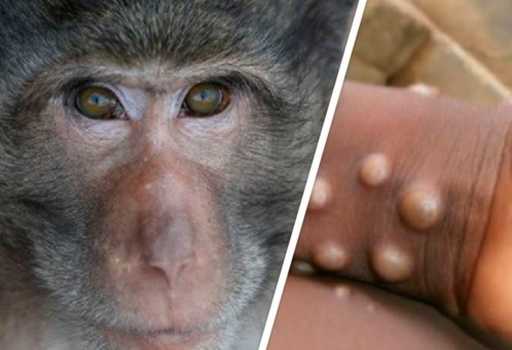 WHO: Število bolezni z živali na človeka v Afriki narašča