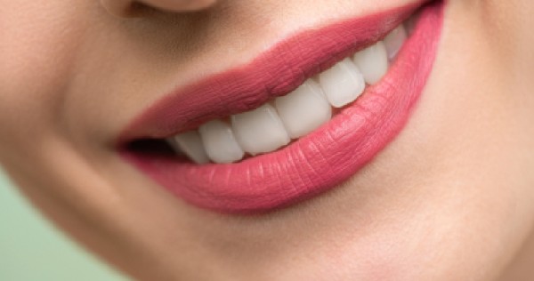 Prijsgids voor het bleken van tanden: Thuiskits, salons of tandartsen?